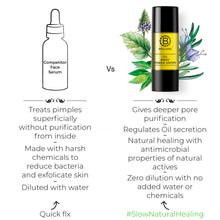Load image into Gallery viewer, Oil Away Power Drops For Oily, Acne Prone Skin
